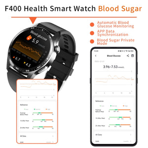 F400  1.55 Inch Screen Smart Watch Support ECG/ Blood Oxygen / Blood Sugar / 150+ Sports Mode